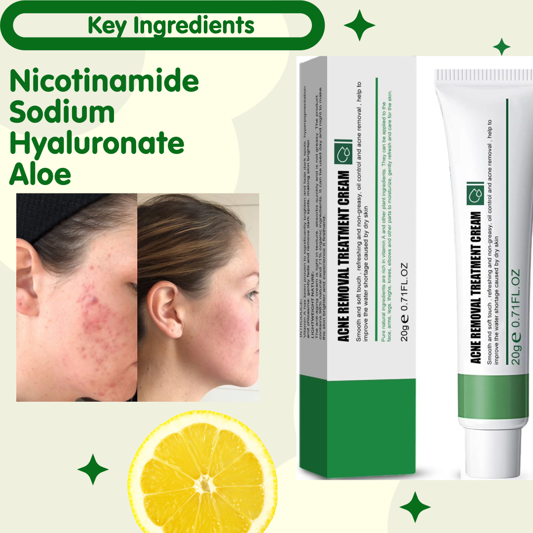 New Effective Acne Removal Cream Acne Treatment Skin Whitening Pimple Acne 20g