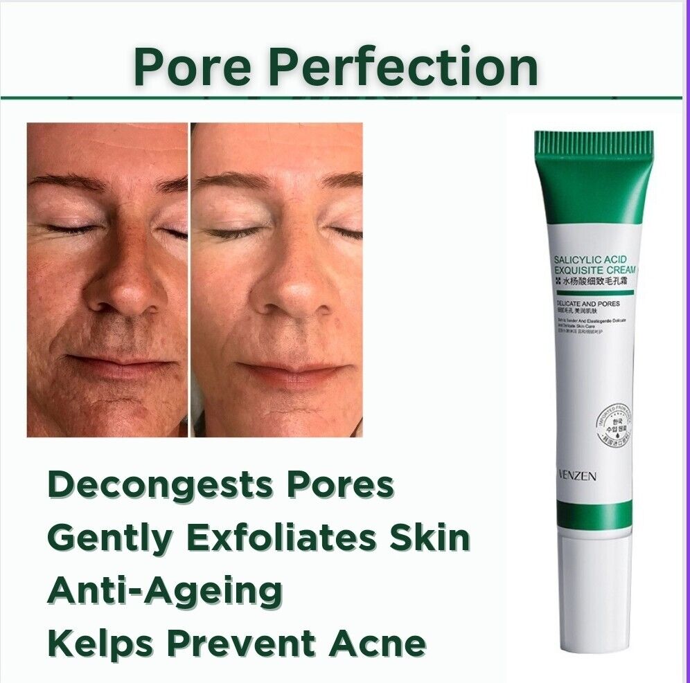 Salicylic Acid Pores Refining Cream Shrink Pore Improve Acnes Blackheads