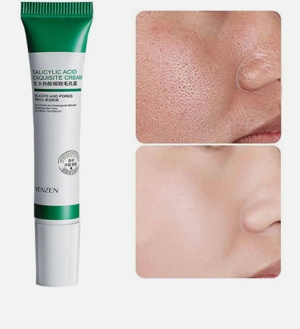 Salicylic Acid Pores Refining Cream Shrink Pore Improve Acnes Blackheads