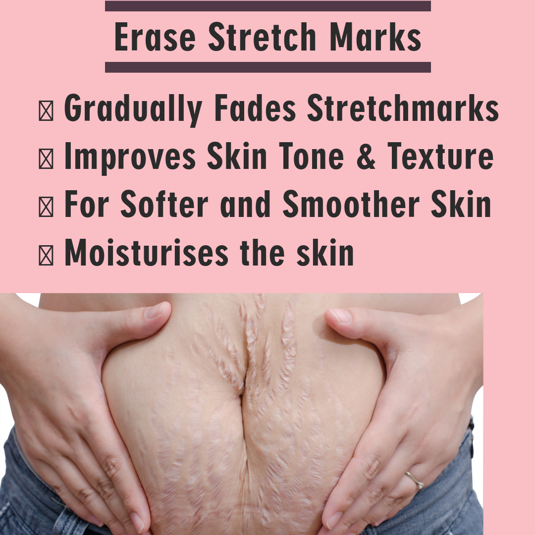Stretch Mark Remover Repair Cream For Postpartum Pregnancy Scar Skin Care