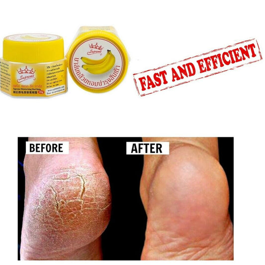 2X Cracked Heels Repair Treatment For Dry Feet  Hard Skin Cream Very Effective