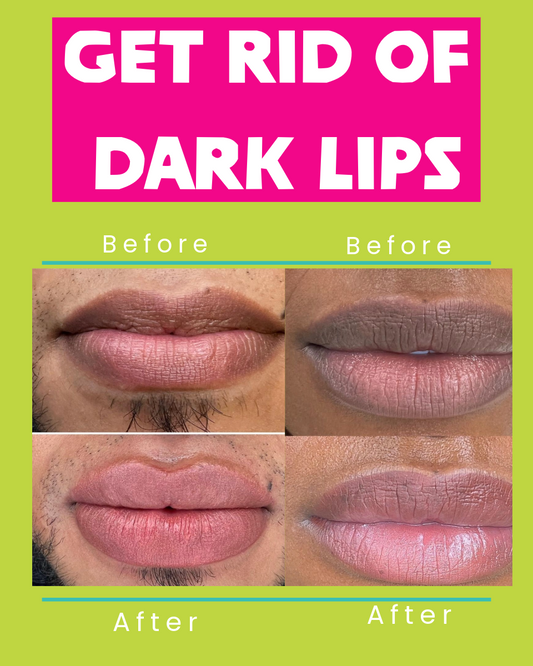 Lip Lightening Bleaching Cream Effective Treatment Remove Dark Smoker Balm