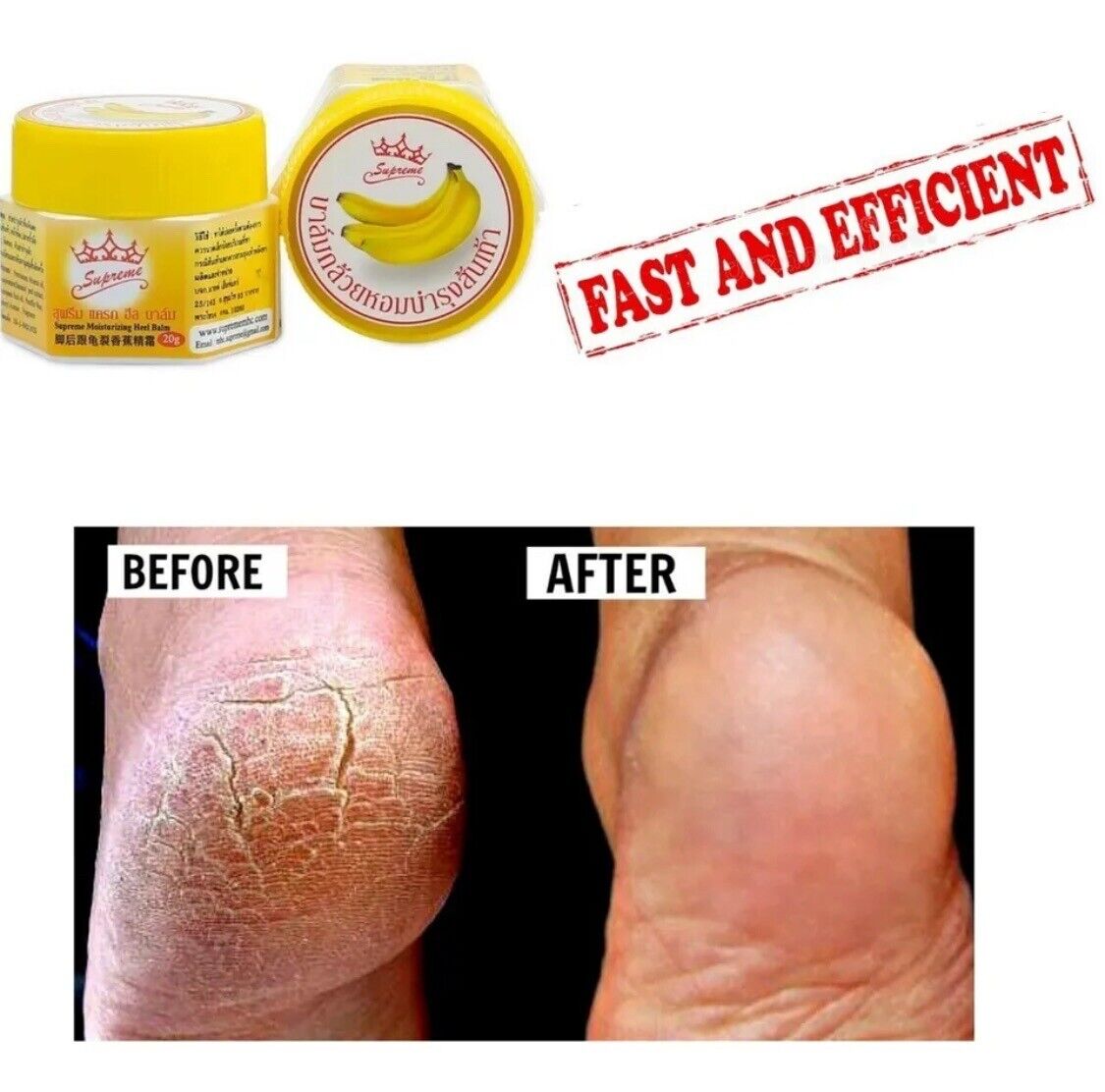 2X Cracked Heels Repair Cream For Very Dry Feet  Hard Skin Cream Very Effective