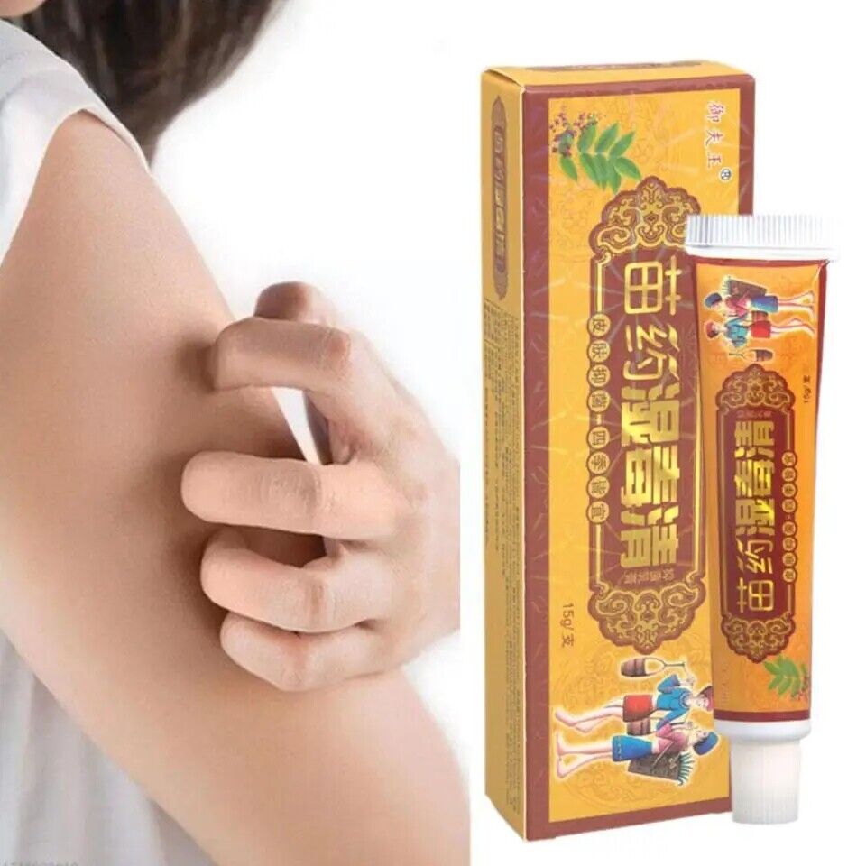 New Body Psoriasis Cream All Body Skin Care Bacteriostasis Dermatitis Eczema 20g