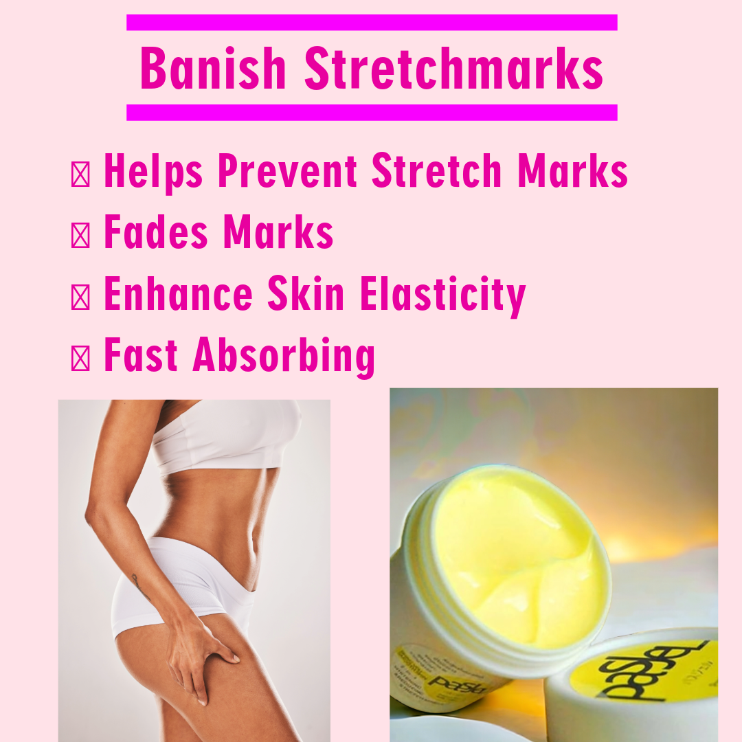 Stretch Marks Removal Cream Pregnancy Scar Cuts Burns Skin Care Repair Cream UK