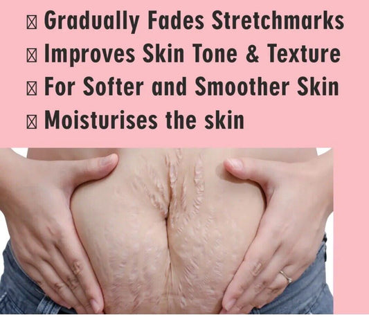 Stretch Mark Remover Repair Cream For Postpartum Pregnancy Scar  Skin Care