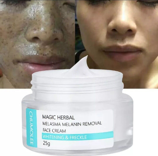 CHUMOLEE Strong Whitening Cream Freckle Cream Remove Melasma Acne Dark Pigment